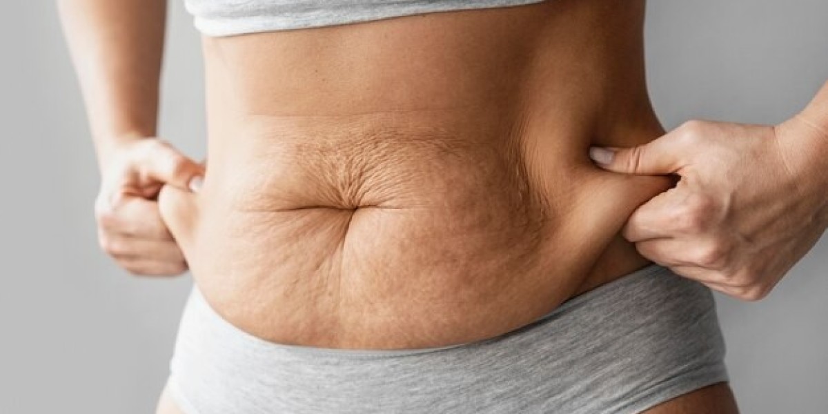 Top-Notch Fat Cavitation at Beverly Hills Med Spa