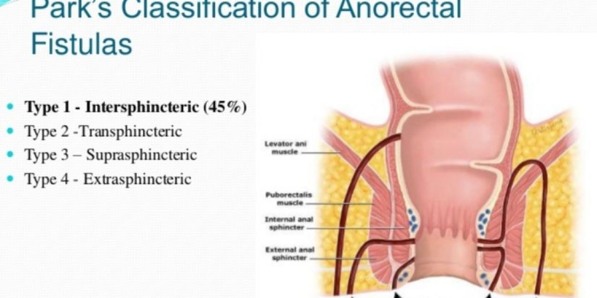 Top Fistula Surgeons in Mumbai: A Comprehensive Guide