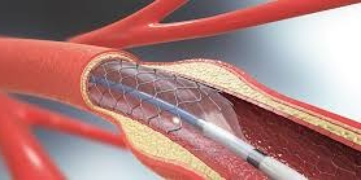 Peripheral Angioplasty in Jaipur: Restoring Blood Flow