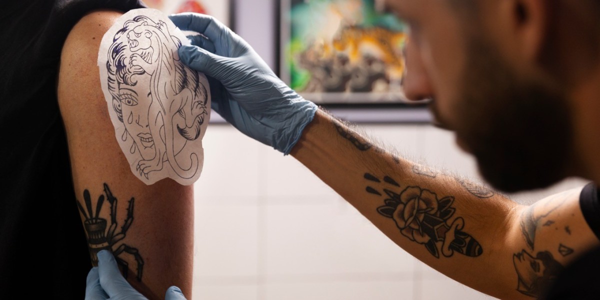 Laser Tattoo Removal Safety Tips