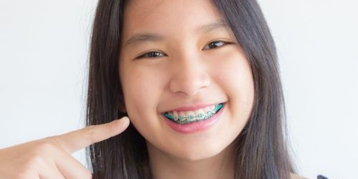 Invisible and Affordable: Clear Braces Options in Singapore