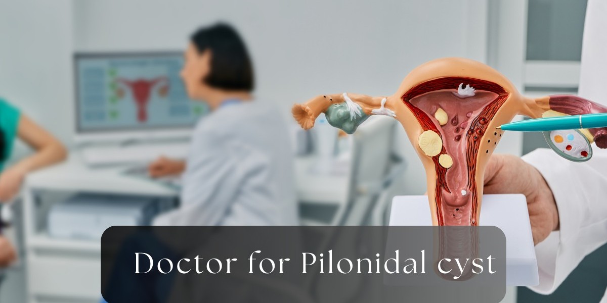 Do You Need a Specialist for Your Pilonidal Cyst? Here’s What to Consider