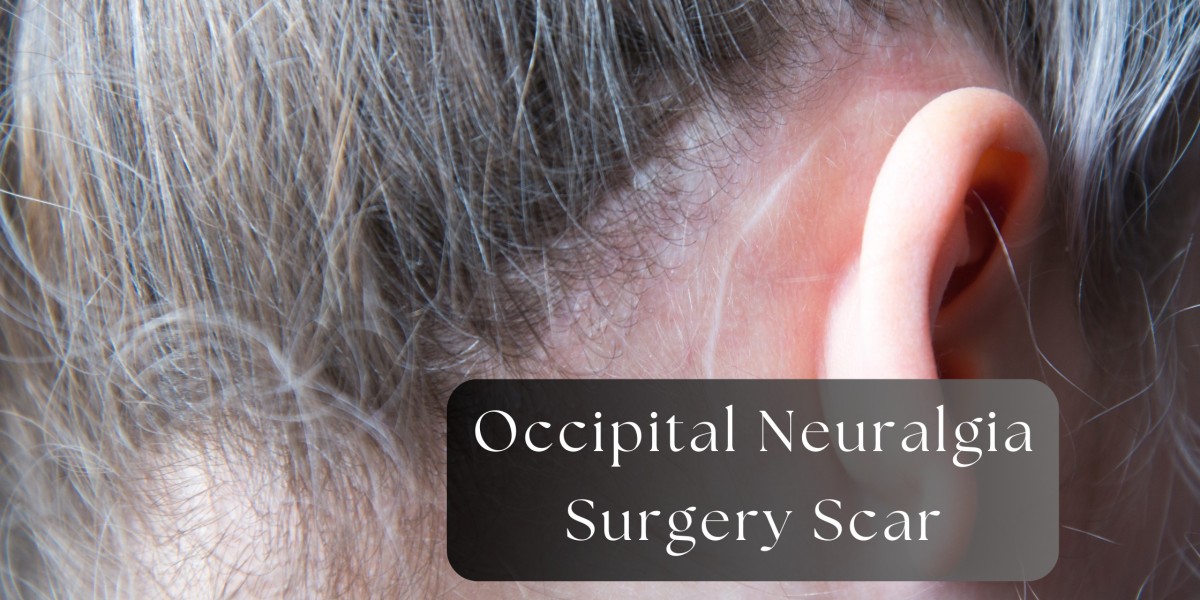 How to Care for Your Occipital Neuralgia Surgery Scar