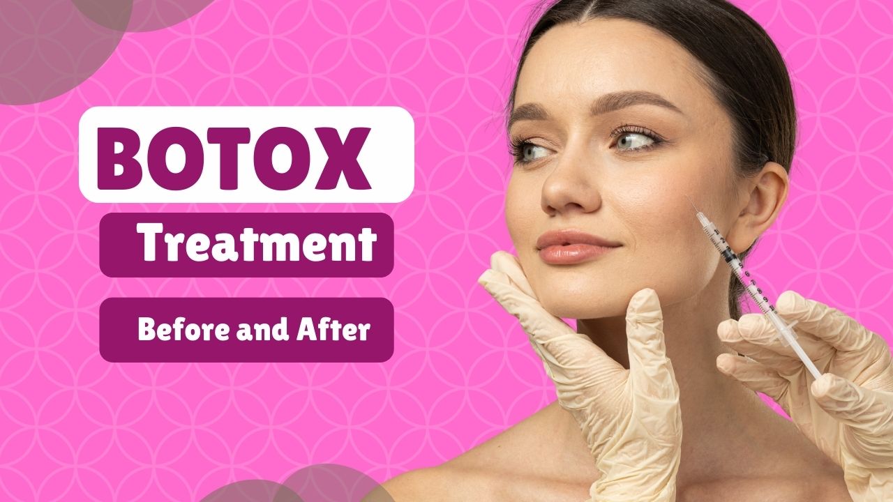 Graceful Looks: How to Get Ready Before Your Botox Treatment