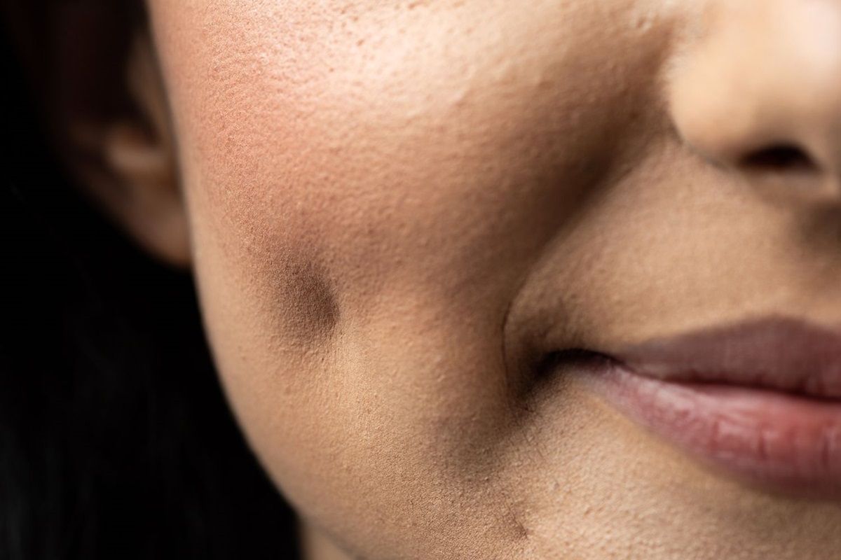 How to Get Dimples: All You Need to Know